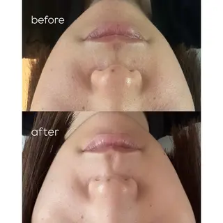 himee所属・艶肌ハーブピーリング /毛穴洗浄のエステ・リラクイメージ