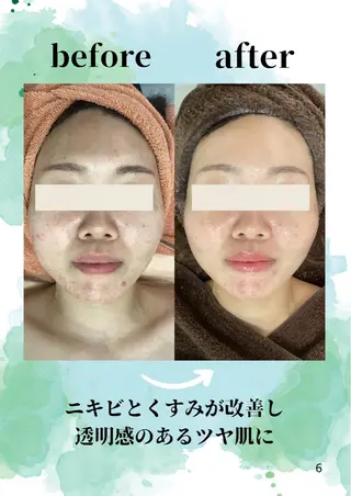 エステ♡Eden Asamiのエステ・リラクイメージ