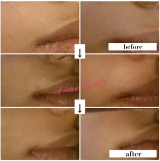 DIONE 麻布十番店のエステ・リラクイメージ