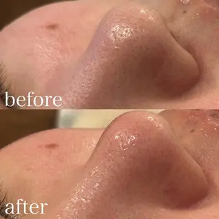 【Beauel】 ここあのエステ・リラクイメージ