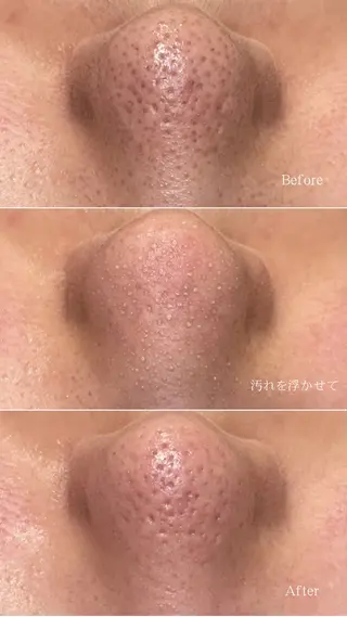 メンズ 新宿大久保美容サロン BELL  マイのその他イメージ