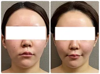 MIRAI小顔 天満橋店のその他イメージ