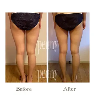 デトックス美容専門サロンｐｅｏｎｙ所属・デトックス美容専門 サロンｐｅｏｎｙのエステ・リラクイメージ