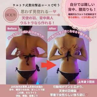 痩身ハーブピーリング 筋膜リリース☆B&Hのエステ・リラクイメージ