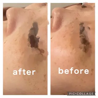 セミロング カラー パーマ ヘアアレンジ メンズ キッズ ネイル マツエク・マツパ アイブロウ ニキビ特化型エステ 🍓最短で肌質改善のエステ・リラクイメージ