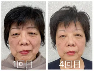 小顔矯正サロンLily所属・小顔矯正サロン Lilyのエステ・リラクイメージ