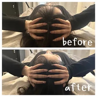 医療提携×美容整体 小顔ハイフピーリングのエステ・リラクイメージ