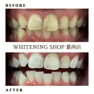 メンズ ホワイトニング ショップ葛西店のその他イメージ