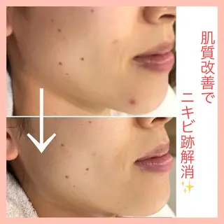 インディバサロン　ソレイユ所属・indiba soleilのエステ・リラクイメージ