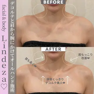 リンデザ 山口のエステ・リラクイメージ