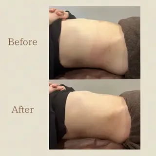 お腹痩せエステ Flat BELLY 恵比寿所属・【腸もみ/冷却痩身】 お腹エステ/恵比寿のエステ・リラクイメージ