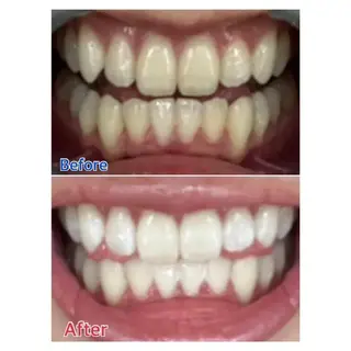 M渋谷店所属・M渋谷 ホワイトニングのエステ・リラクイメージ