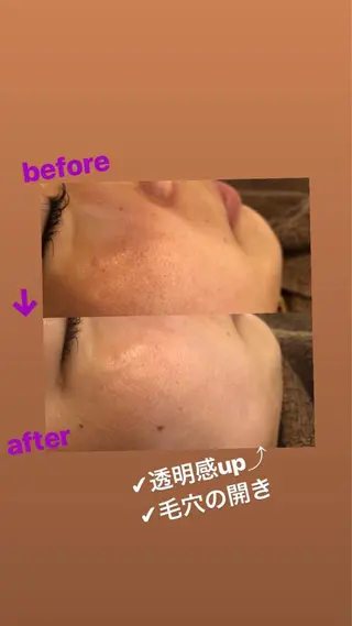 美容鍼・鍼灸専門❤✨ 近藤めぐみのエステ・リラクイメージ