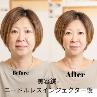 北梅田美容鍼灸院所属・美容鍼マイスター 川村　淳のエステ・リラクイメージ