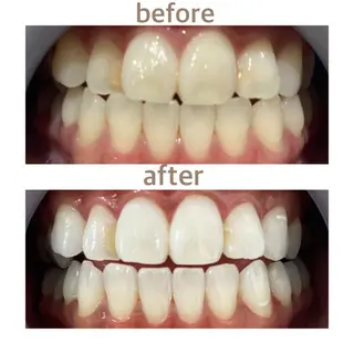 メンズ ホワイトニング ショップ船橋2号店のエステ・リラクイメージ