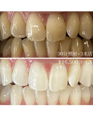 メンズ ホワイトニングルーム　川崎店所属・ホワイトニング ルーム　川崎店のその他イメージ