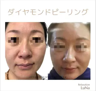 リラクゼーション ルナのエステ・リラクイメージ
