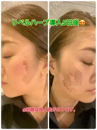 Dione八王子店所属・LUKE （ルーク）のエステ・リラクイメージ