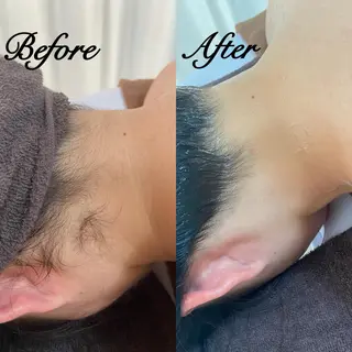 都度払い制脱毛サロンBe Charm所属・Be Charm 山﨑のエステ・リラクイメージ