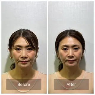 美容鍼灸整体サロンCHARMEB【シャルム】所属・馬場 武のエステ・リラクイメージ