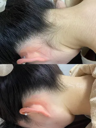 シミケア/ハーブピーリング/脱毛/小顔フェイシャル/ハーブ温浴　LAULEA所属・素肌をキレイに ラウレア🌼Hayaのエステ・リラクイメージ