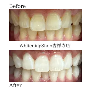 ホワイトニング ショップ吉祥寺店のエステ・リラクイメージ