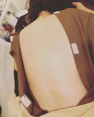 水島 秀輝（美容鍼灸師）のその他イメージ