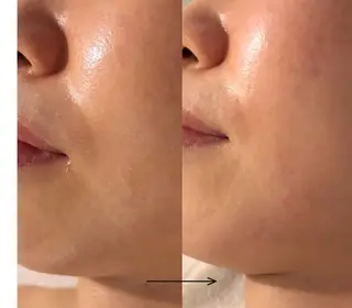 POLA THE BEAUTY 天王寺店所属・UEDA | POLA 天王寺のエステ・リラクイメージ