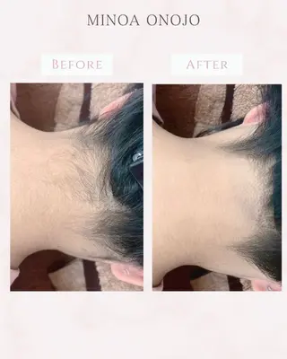 MINOA所属・MINOA 井上🌷のエステ・リラクイメージ