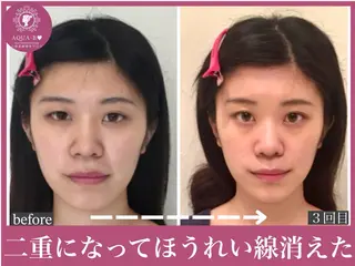 盛れる小顔矯正師 たく先生のエステ・リラクイメージ