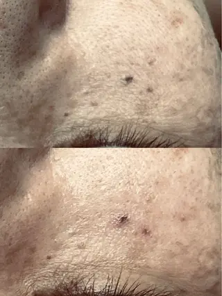 ◯△□所属・最新美肌脱毛 韓国水光肌🫧のその他イメージ