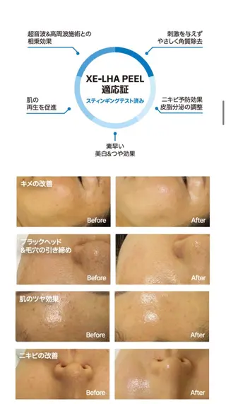 レティティア【Laetitia】所属・レティティア秋葉原店 Yoshizawaのエステ・リラクイメージ