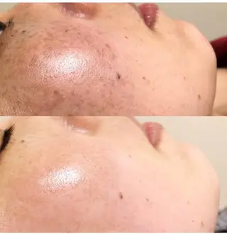 LiZA エステティックサロンのエステ・リラクイメージ