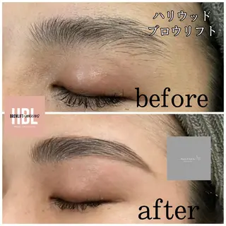 marron所属・痩身ハイパーナイフ ララピールリアボーテのエステ・リラクイメージ