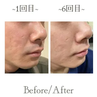 メンズサロンGRACE所属・salon GRACEのエステ・リラクイメージ