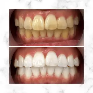 LBSホワイトニング 🌐渋谷店スタッフのエステ・リラクイメージ