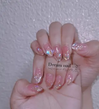 ミディアム ネイル フィルイン、長さ出し 深爪矯正のネイルデザイン