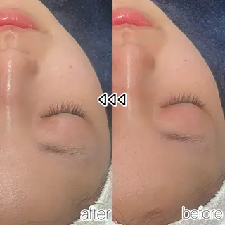 OPS×LIFE BEAUTY所属・OPS×LIFE BEAUTY/みきのエステ・リラクイメージ