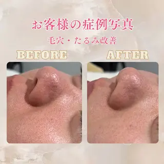 pansy(パンジー)上野フェイシャルエステ専門店所属・pansy saraのエステ・リラクイメージ