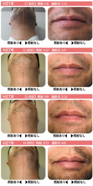 高速脱毛エステ リアンのエステ・リラクイメージ