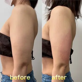 Miiju.所属・Miiju. 石巻市 脂肪冷却  鈴木のエステ・リラクイメージ