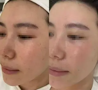 ネイル aliaハイフ&水光ジェットサロン所属・aliaハーブ水光店 エステティシャン募集のエステ・リラクイメージ