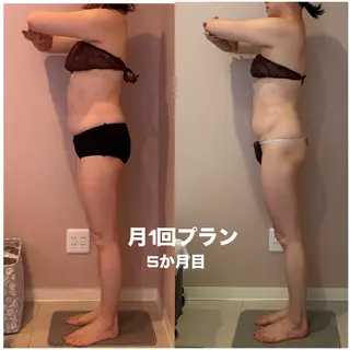 美容整体エステ　Asmy神戸板宿店所属・美容整体エステ ASMY神戸板宿店のエステ・リラクイメージ