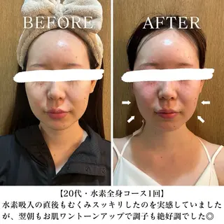 【西荻窪】本格痩身 最新型よもぎ蒸しのエステ・リラクイメージ