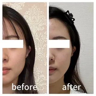 小顔サロン AMYONのエステ・リラクイメージ