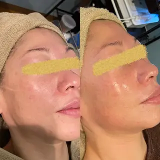 petit Orb所属・petit Orb 大谷梨紗のエステ・リラクイメージ