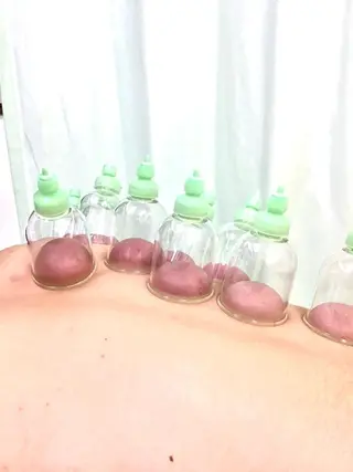 祖師谷ヒカリ 接骨院のエステ・リラクイメージ