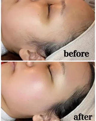 多摩境Beauty Salon  ViVi所属・多摩境ViVi chinamiのエステ・リラクイメージ