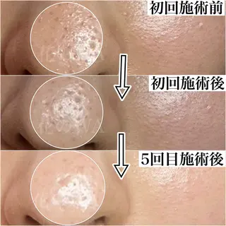 毛穴&リンパマッサージ専門サロン　花のWA所属・毛穴&リンパマッサー ジ専門サロン花のWAのエステ・リラクイメージ