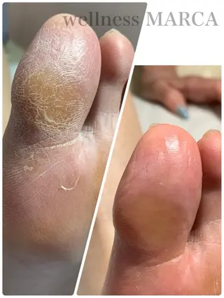 ネイル メンズトータルビューティーwellnessMARCA所属・【メンズ美容】 三浦かえでのネイルデザイン